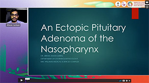 An Ectopic Pituitary Adenoma of the Nasopharynx